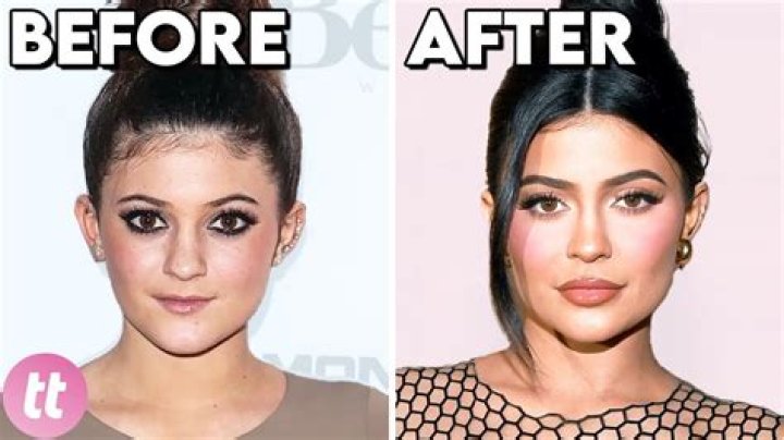Extreme Sisters Triplets Before Plastic Surgery