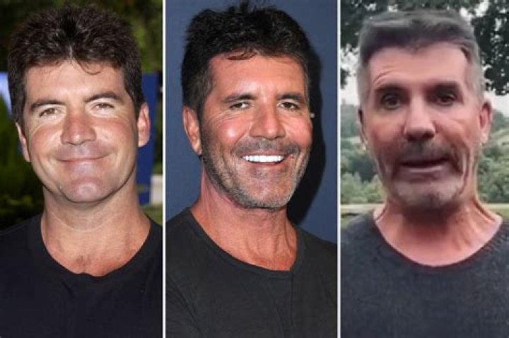 Simon Cowell 2023 Accident: What Really Happened?